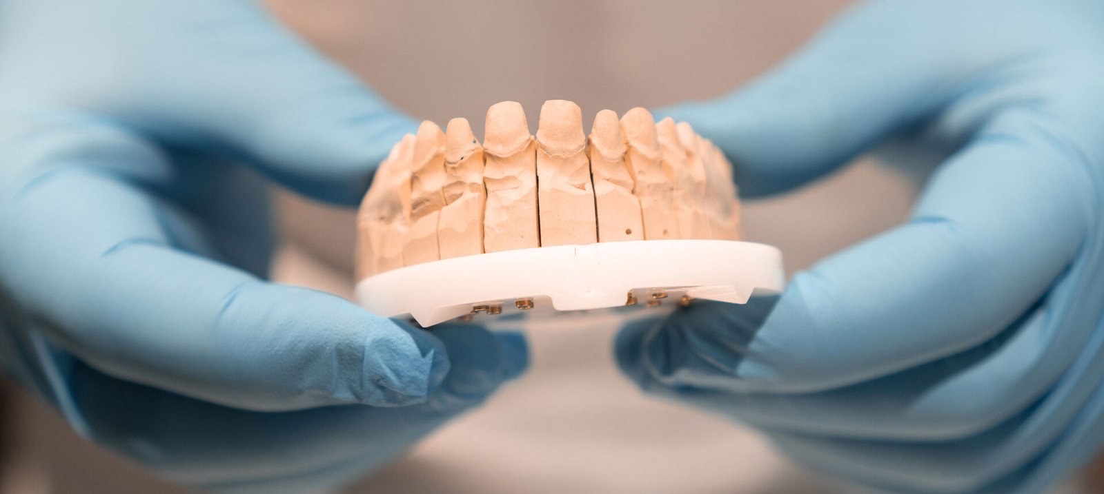 Renton dental office Go Dentistry provides restorative dental care