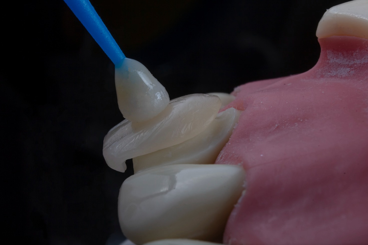 How Dental Implants Can Transform Your Life